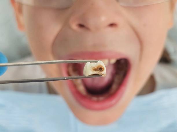 Best Emergency Dentist for Kids  in Rector, AR